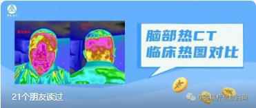 脑部热CT热图直观、清晰！你我也能轻松看懂热图的区别对比！